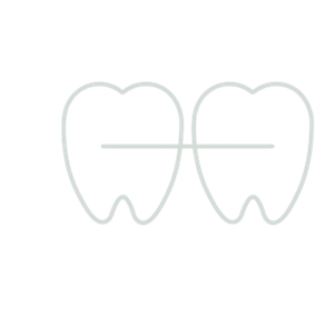 Teeth Straightening