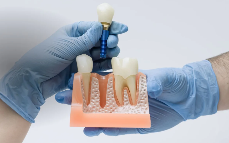 Clinical 3D scan and diagnostic planning Beech House Dental